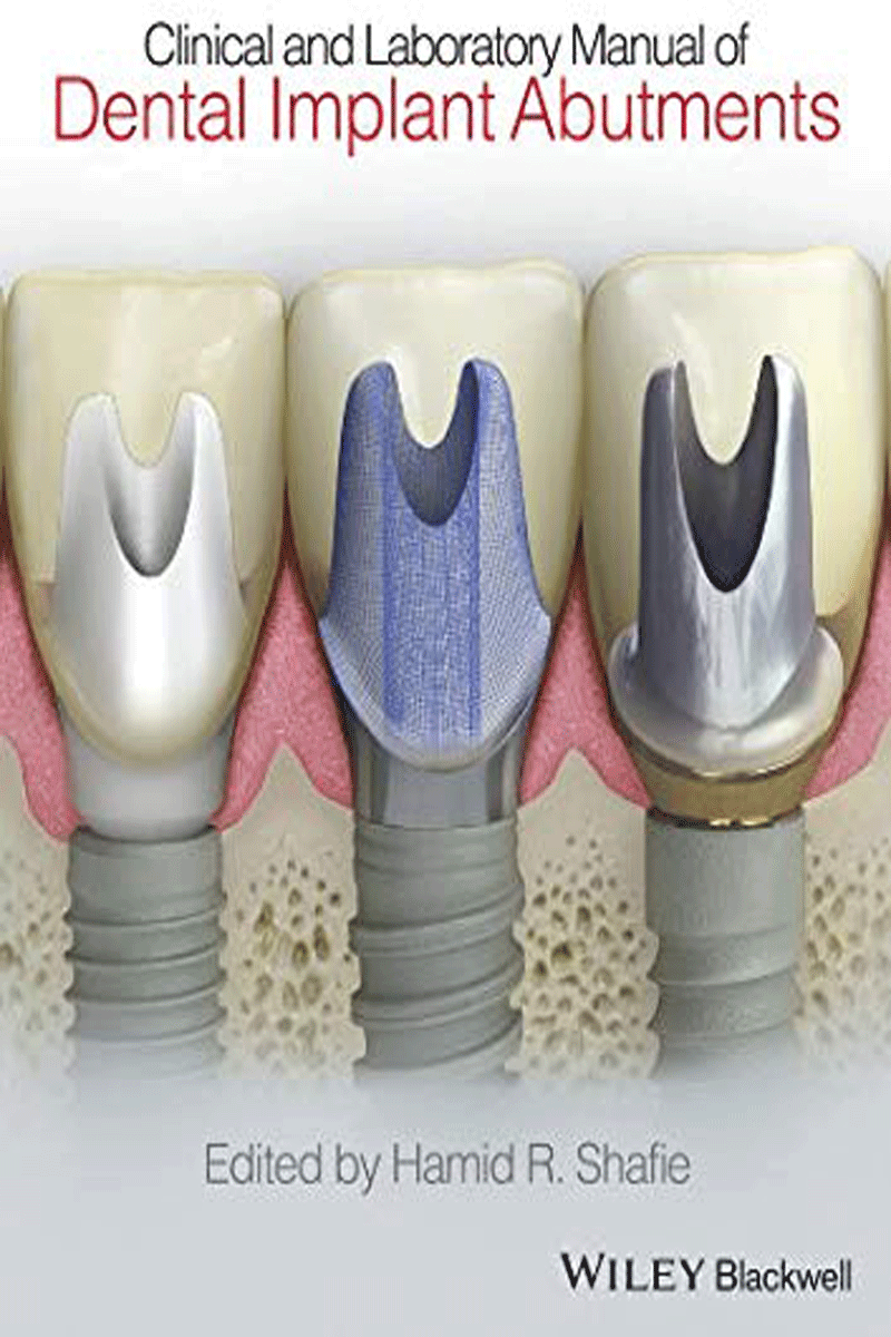کتابClinical and Laboratory Manual of Dental Implant Abutments- نویسندهHamid R. Shafie