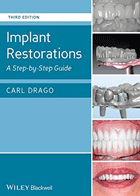 کتابImplant Restorations A Step-by-Step Guide- نویسندهCarl Drago