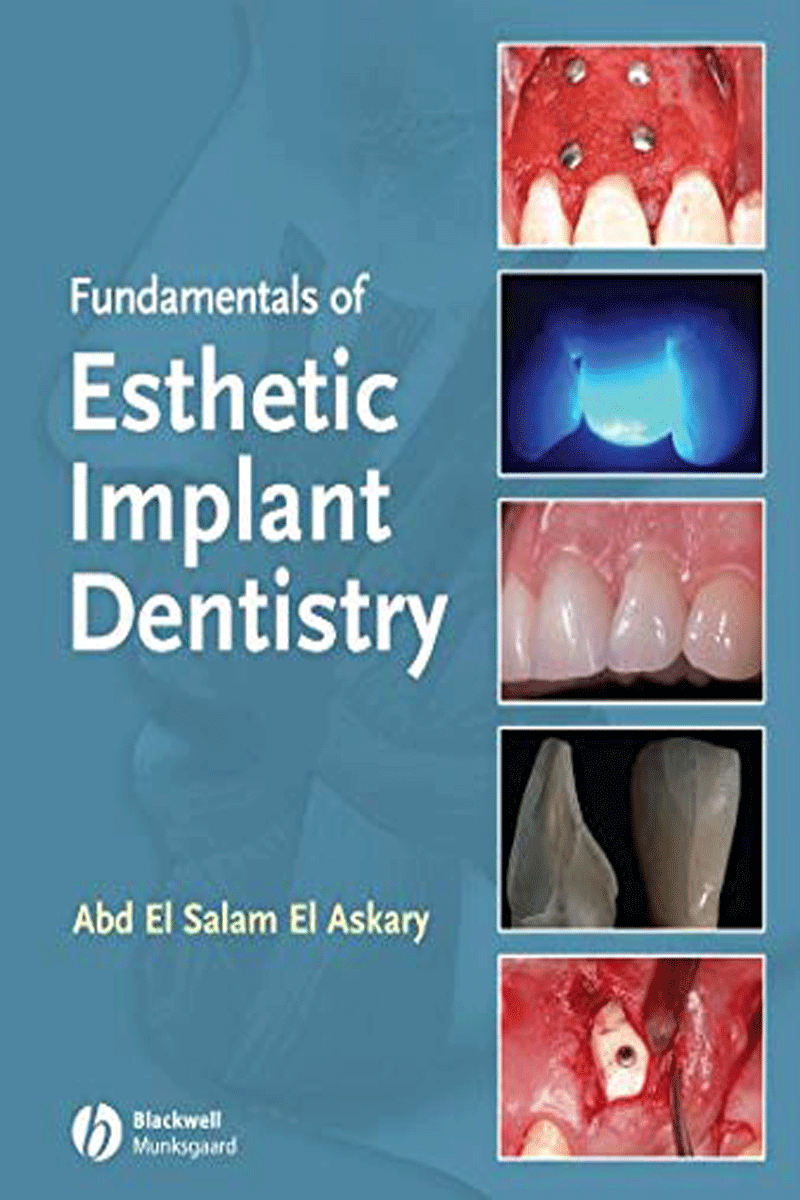 کتابFundamentals of Esthetic Implant Dentistry- نویسنده	Abdelsalam Elaskary