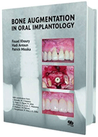کتابBone Augmentation in oral implantology- نویسنده	Fouad Khoury