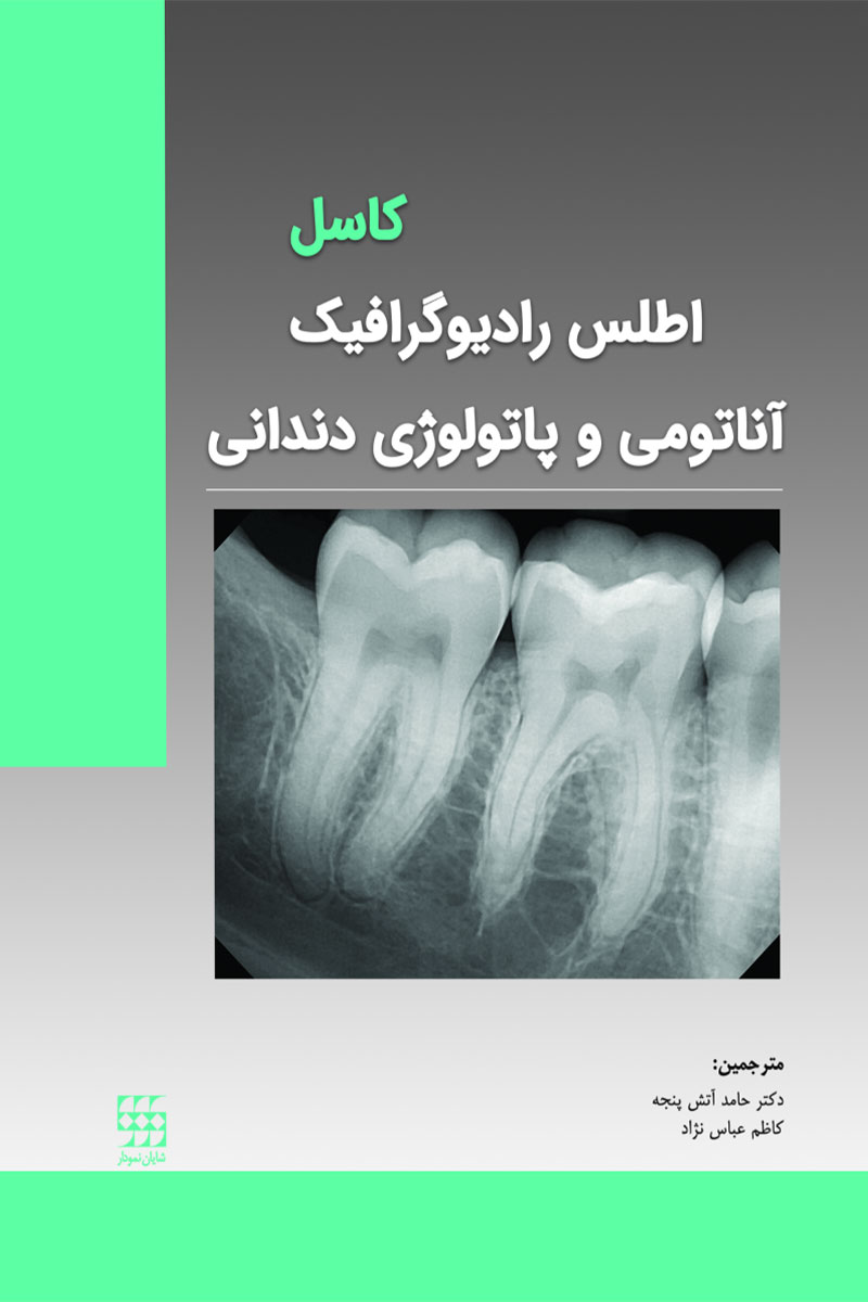 کتاب اطلس رادیوگرافیک آناتومی و پاتولوژی دندانی-کاسل-نویسنده دکترحامد آتش پنجه