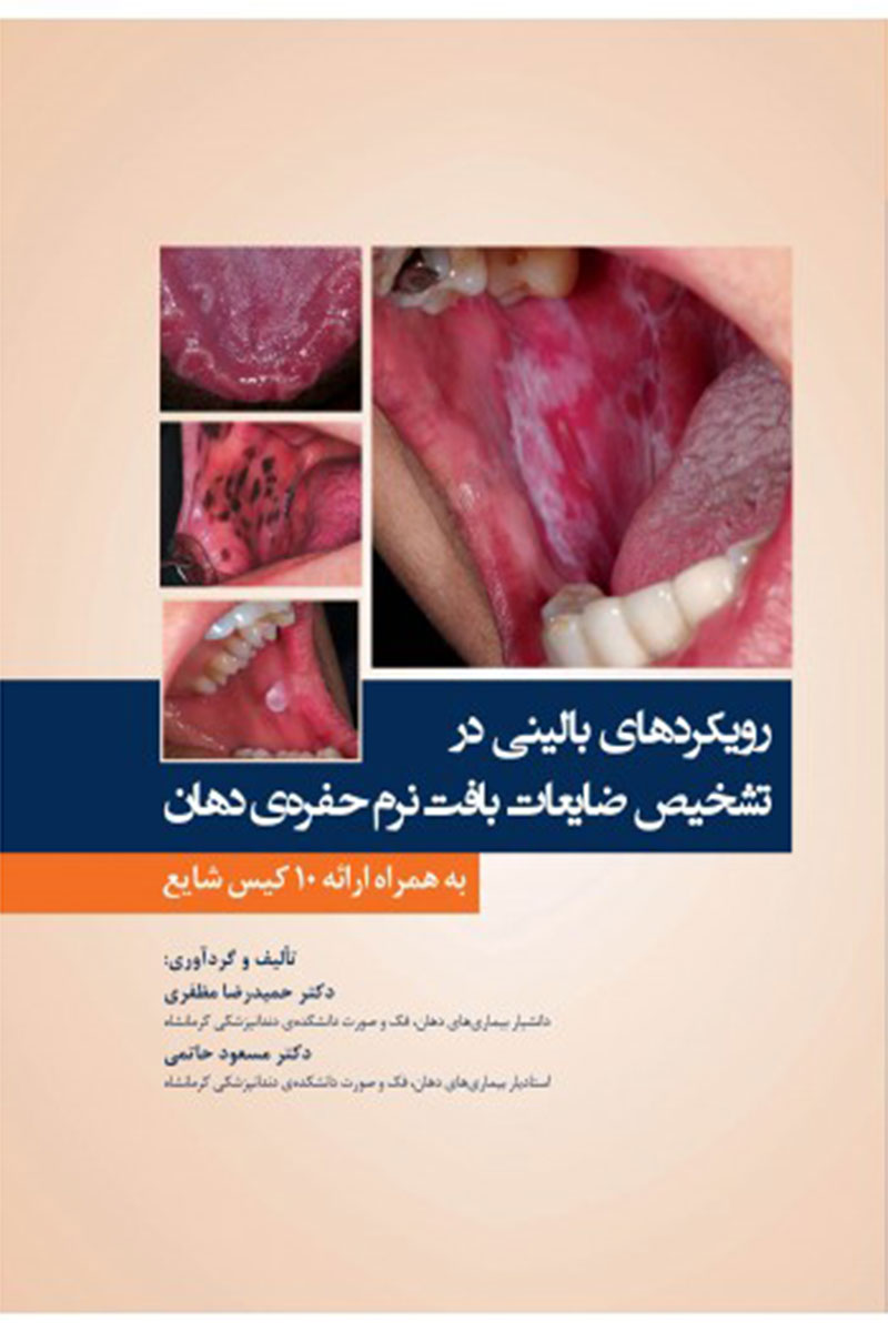 کتاب رویکردهای بالینی در تشخیص ضایعات بافت نرم حفره ی دهان به همراه ارائه 10 کیس شایع -نویسنده دکتر حمیدرضا مظفری