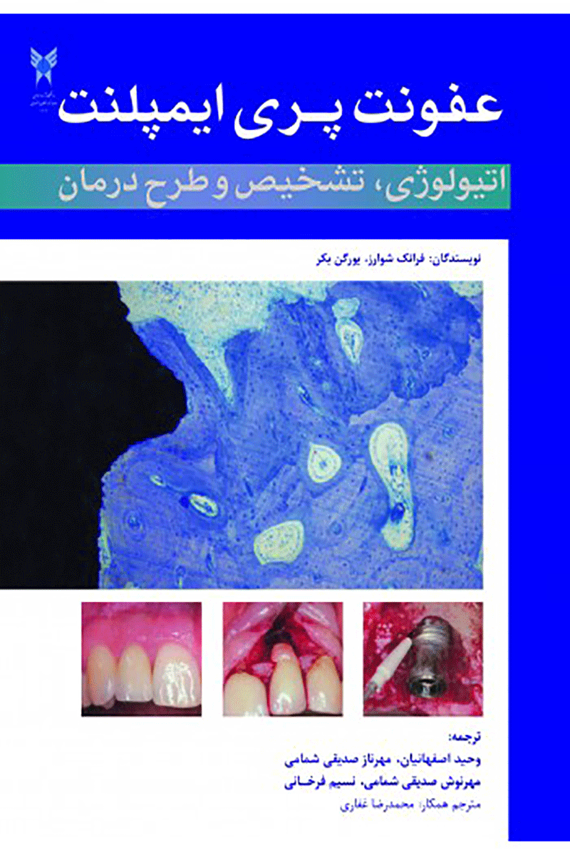 کتاب عفونت پری ایمپلنت اتیولوژی تشخیص و طرح درمان-نویسنده وحید اصفهانیان