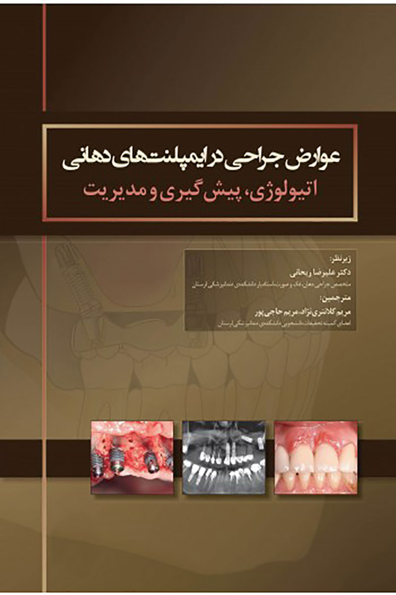 کتاب  عوارض جراحی در ایمپلنت های دهانی اتیولوژی، پیشگیری و مدیریت- ترجمه  دکتر علیرضا ریحانی   