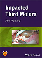 کتاب Impacted Third Molars2018-نویسنده WILEY  Blackwell
