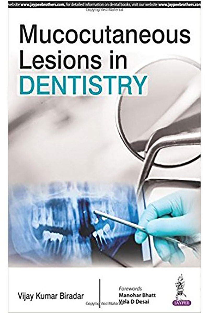 کتابMucocutaneous Lesions in Dentistry 2016-نویسندهVijay Kumar Biradar