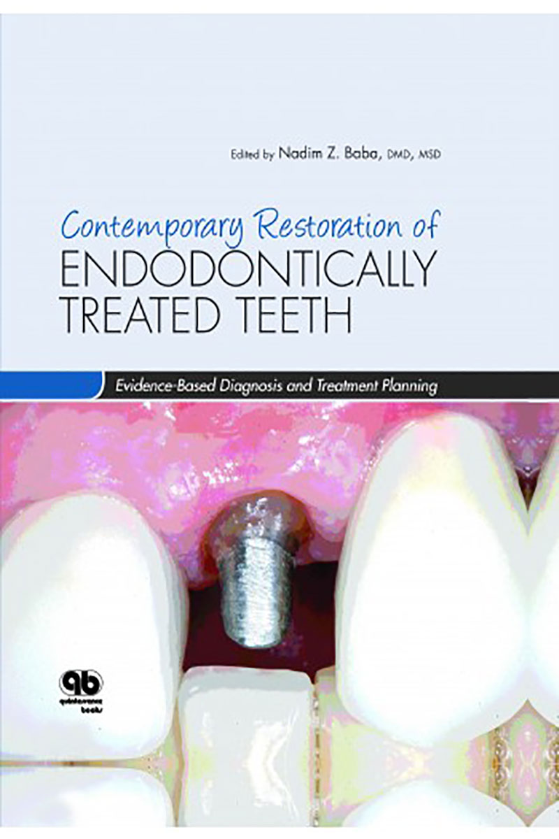 کتابContemporary Restoration ENDODONTICALLY TREATED TEETH Evidence Based Diagnosis and Treatment Planning 2013- نویسندهNadim Z. Baba