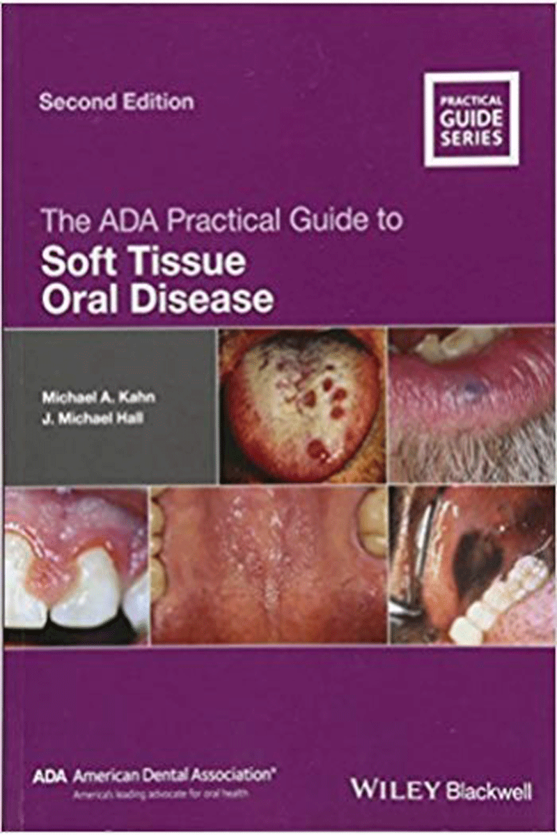 کتاب The ADA Practical Guide to Soft Tissue Oral Disease2018 