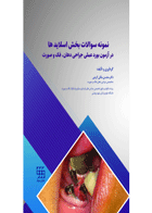 کتاب نمونه سوالات بخش اسلایدها در آزمون بورد عملی جراحی دهان فک و صورت-نویسنده دکتر محسن ملکی گرجی 