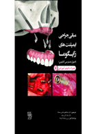 کتاب مبانی جراحی ایمپلنت های زایگوما اصول دسترسی آناتومی-نویسنده بی بی ملیحه آذربنیاد