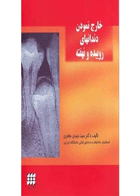کتاب خارج نمودن دندانهای روییده و نهفته-نویسنده دکتر سید مهدی جعفری
