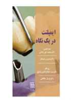 کتاب ایمپلنت در یک نگاه-نویسنده Jacques Malet -مترجم دکتر محمدتقی باغانی