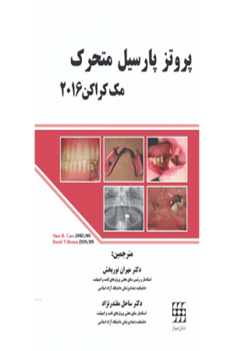 کتاب پروتز پارسیل متحرک مک کراکن ۲۰۱۶-نویسنده Alan B. Carr-مترجم دکتر مهران نوربخش