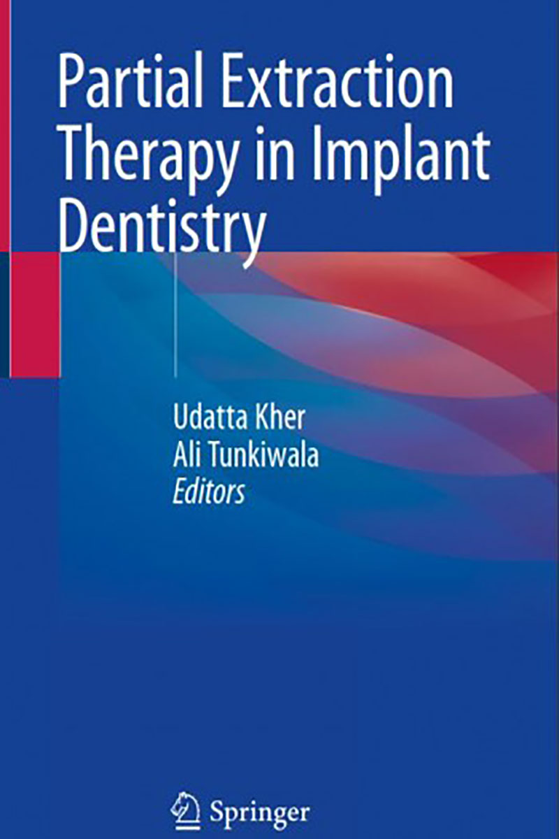 کتابPartial Extraction Therapy in Implant Dentistry 2020- نویسندهUdatta Kher
