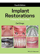 کتابImplant Restorations2020- نویسندهCarl Drago