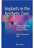 کتابImplants in the Aesthetic Zone2018- نویسندهTodd R. Schoenbaum