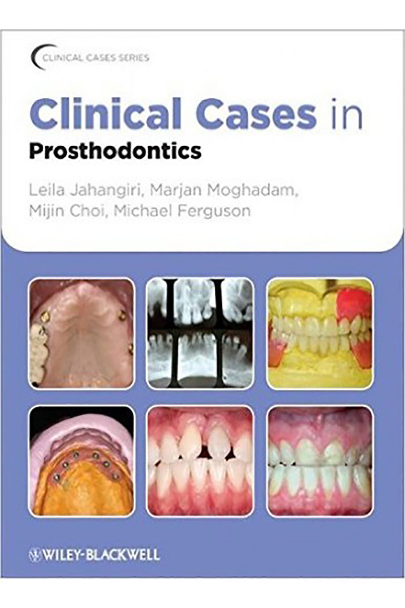کتابClinical Cases in Prosthodontics2011- نویسندهLeila Jahangiri