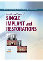 SINGLE IMPLANT and RESTORATION 2014- نویسندهTorabinejad