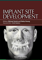 کتابImplant Site Development- نویسندهMichael Sonick